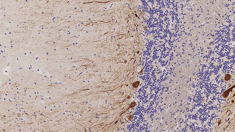 1ml NCL-L-NF200-N52 产品照片