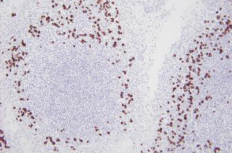 BOND Lambda 探针 产品照片 Front View S