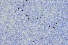 5.5 ml Bond EBER Probe 产品照片