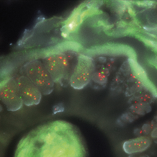 AURKA (20q13) / 20q11 Produktfoto