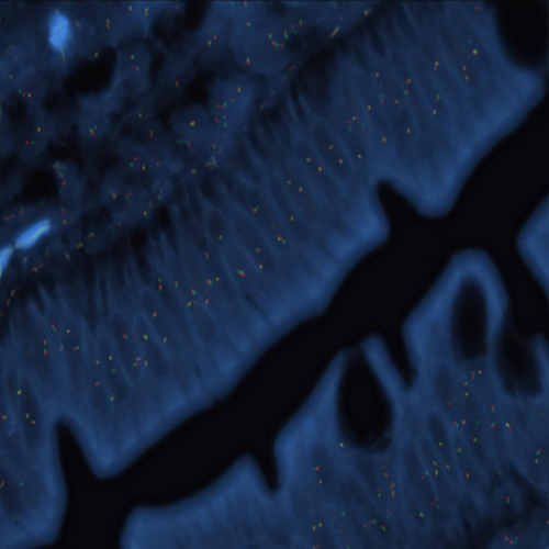 IVD IGH Break (tissue) Produktfoto Front View S