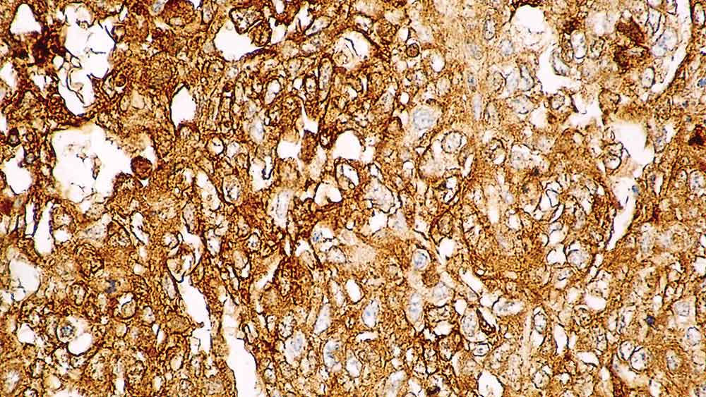 Alpha Fetoprotein Produktfoto Front View S