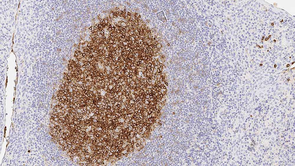 CD10 Produktfoto Front View S