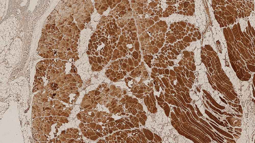 Dysferlin Antibodies Produktfoto Front View S