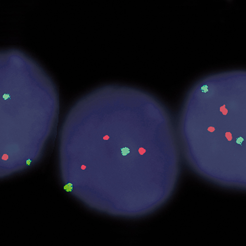 IVD GLI1/SE 12 Produktfoto Front View S