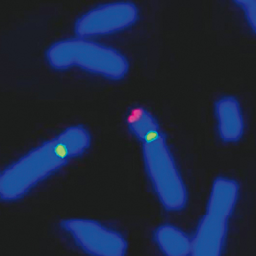 IVD WHSC1/SE 4 Produktfoto Front View S