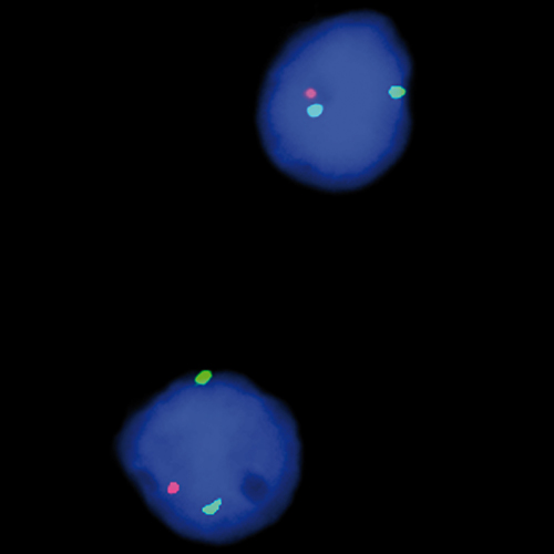 IVD PTEN/SE 10 Produktfoto