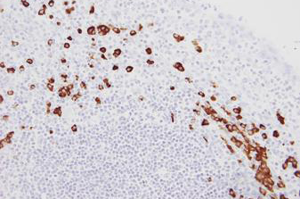 BOND Kappa Probe Produktfoto Front View S