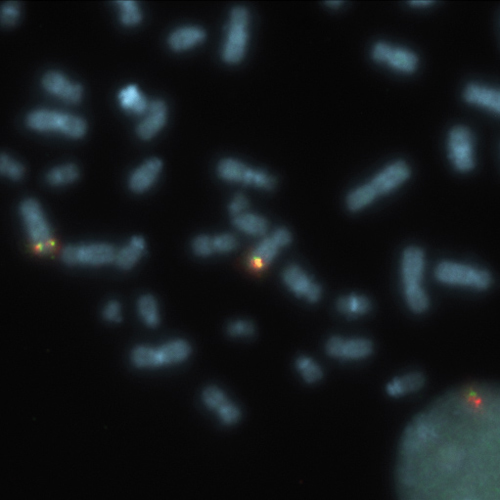 PDGFRB (5q32) Break product photo