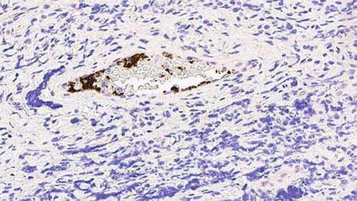 CD61 (GPIIIa) product photo Front View S