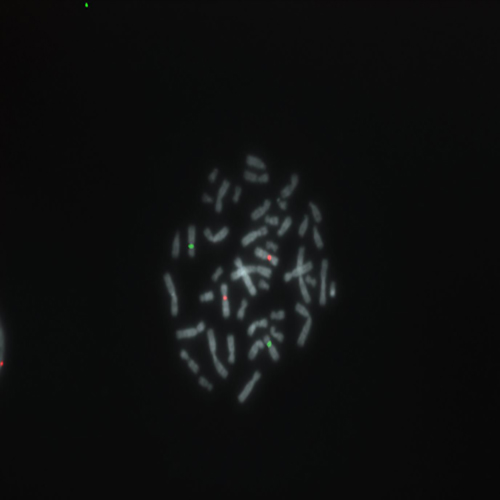 IVD SE 7/SE 8 product photo Front View S