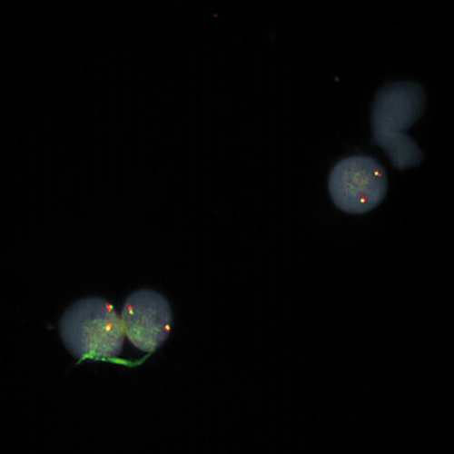 IVD JAK2 Break product photo Front View S