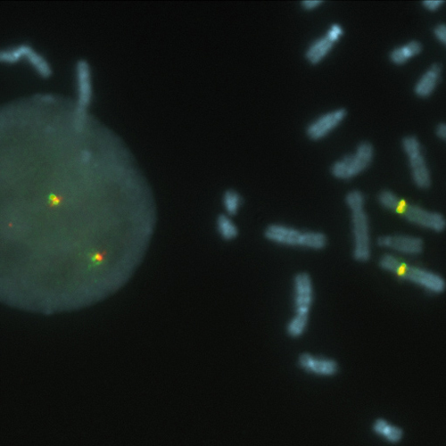 IVD FIP1L1/CHIC2 /PDGFRA Dual-Color product photo