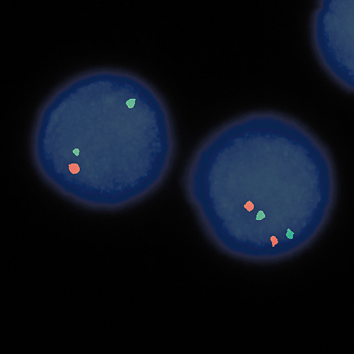 IVD ATM/SE 11 product photo