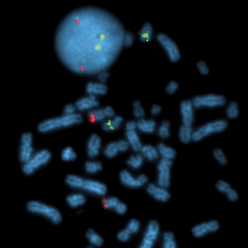 IVD 15q22/9q34 product photo Front View S