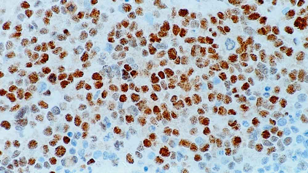 Myogenin (Myf-4) product photo