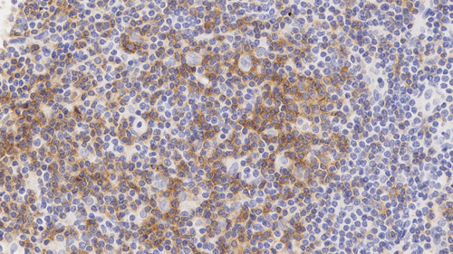 7mL PD-1 (CAL20) BOND RTU Primary product photo