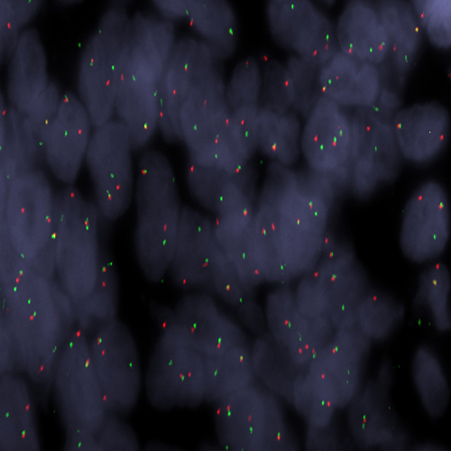 SS18 (18q11) Break – XL for BOND product photo Front View S