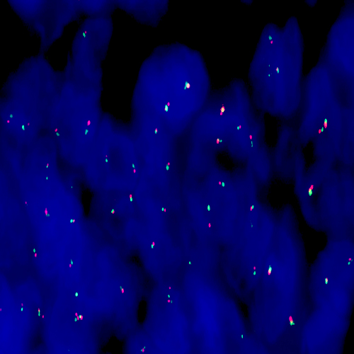 IVD BCL6 (3q27) Break - XL for BOND product photo Front View S