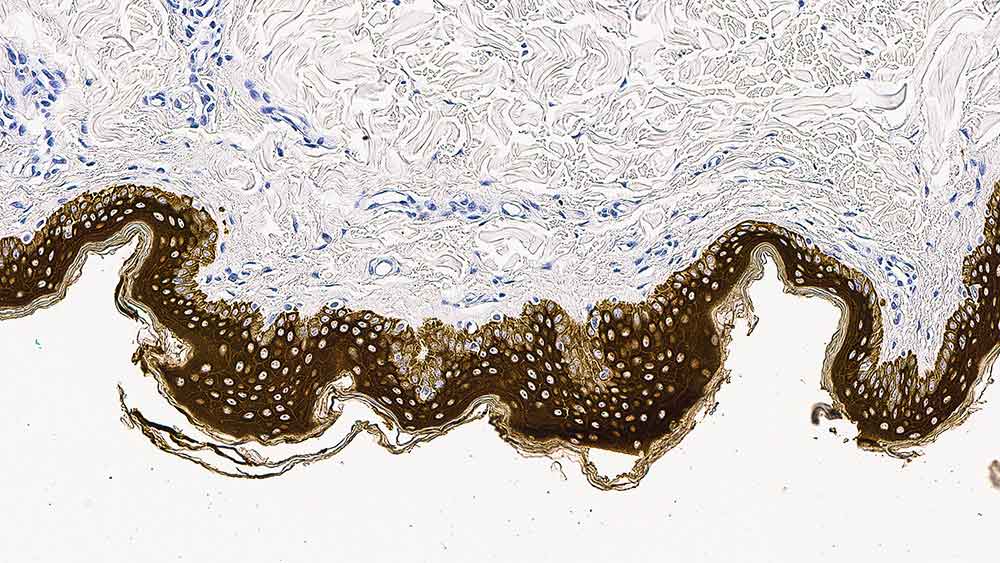 Cytokeratin (5/6/18) product photo