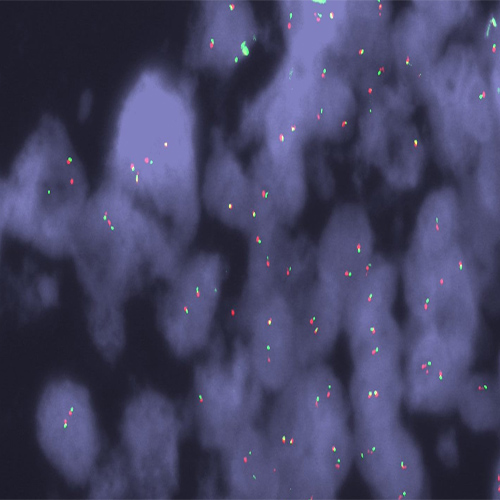 NTRK1 (1q23) Break – XL for BOND product photo
