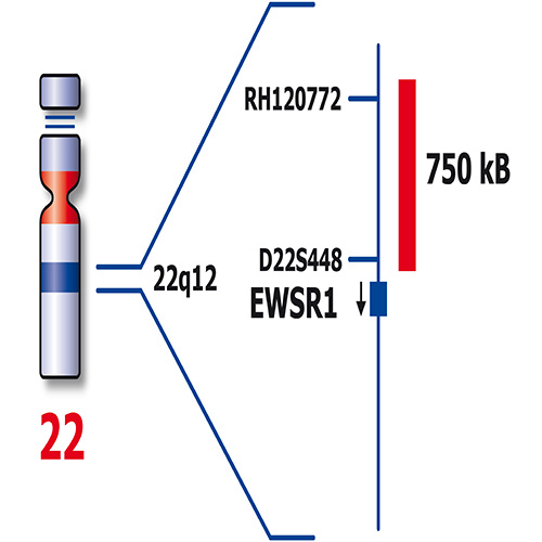 IVD EWSR1/NFATC product photo Side View S