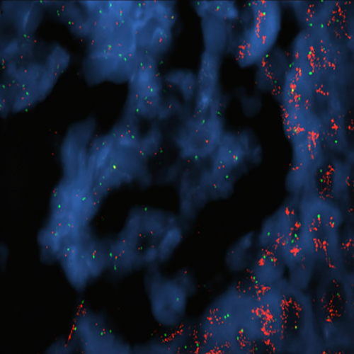 IVD ERBB2/SE 17 photo produit Front View S