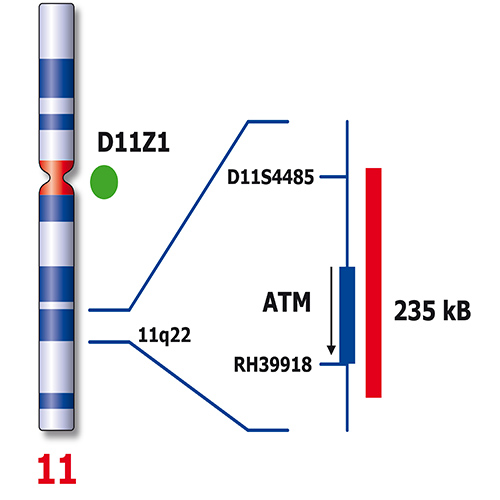 IVD ATM/SE 11 photo produit Back View S