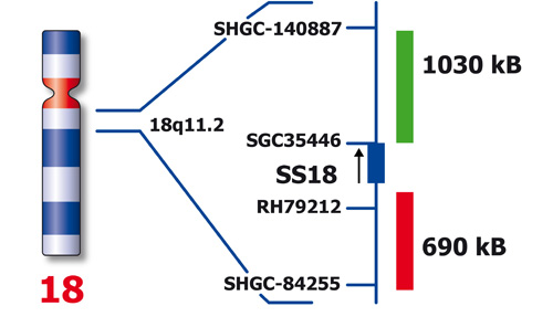 SS18 (18q11) Break – XL for BOND photo produit Back View S