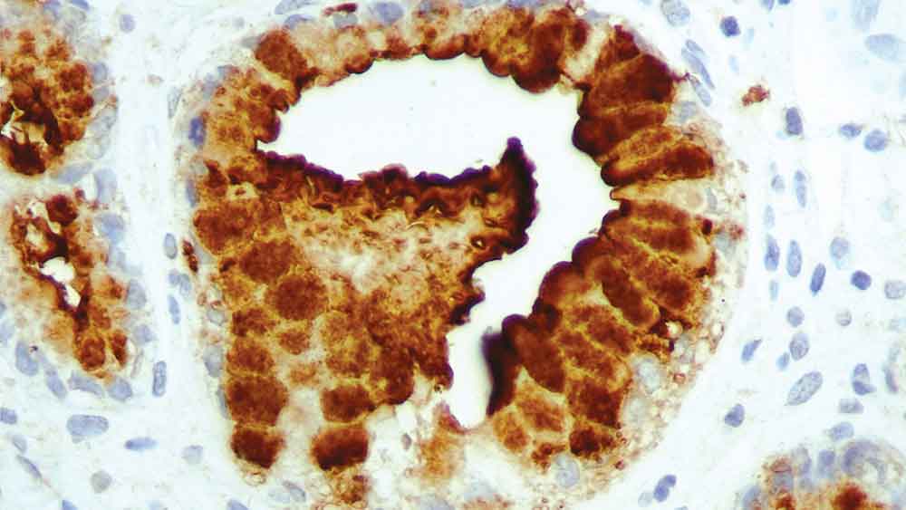 1ml NCL-L-CA19-9 photo produit