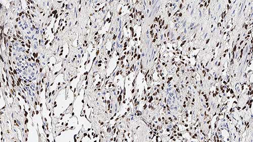 Human Herpesvirus Type 8 (HHV8) photo produit