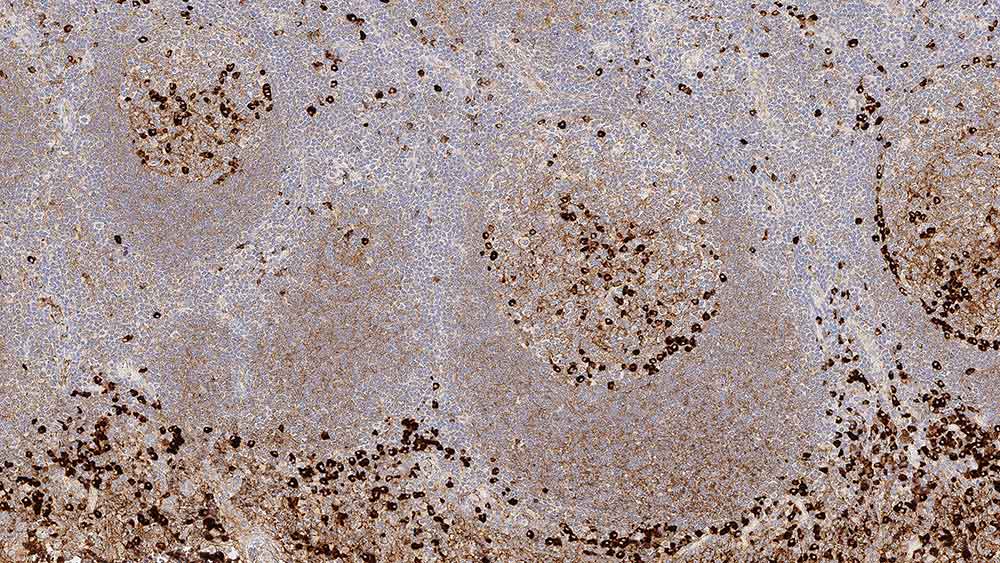 Immunoglobulin G photo produit Front View S