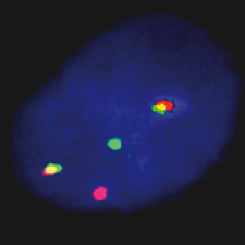 IVD FGFR3/IGH photo produit Front View S