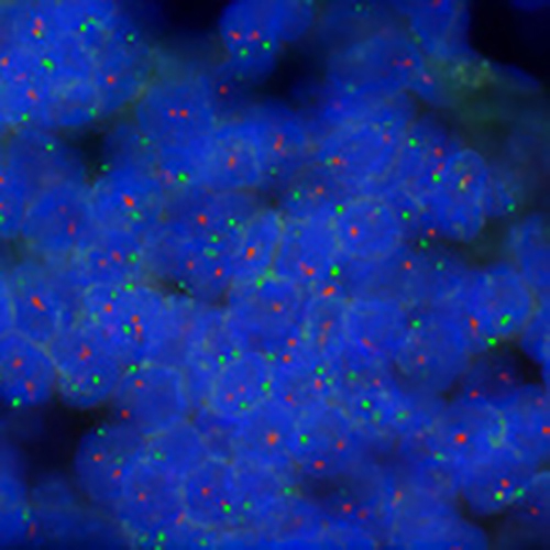 IVD BCL2/IGH (tissue) photo produit Front View S