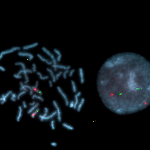 IVD SNRPN/PML photo produit Front View S