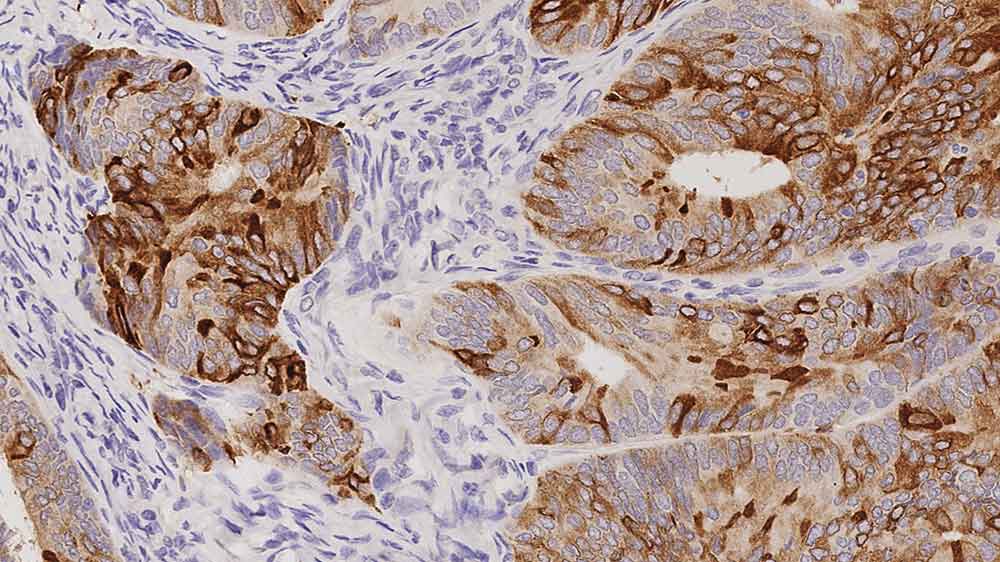 Mammaglobin photo produit