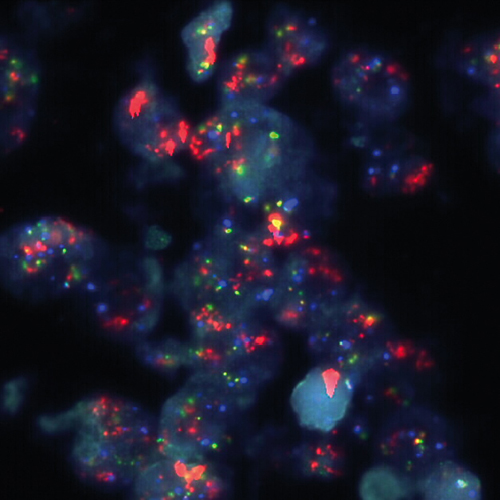 IVD TOP2A/ERBB2/SE 17 photo produit Front View S