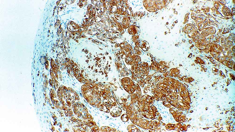 Tyrosinase photo produit Front View S