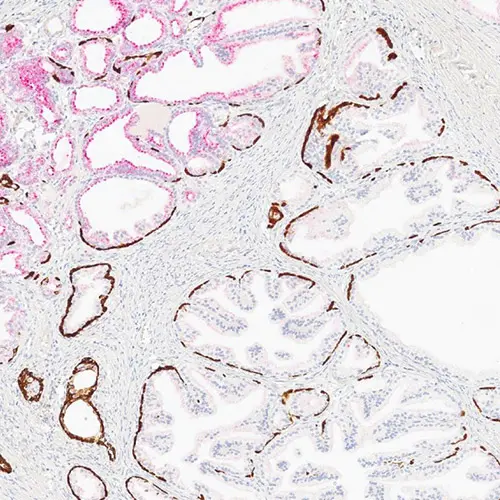 Leica ChromoPlex 1 Dual Detection for BOND photo produit Side View S