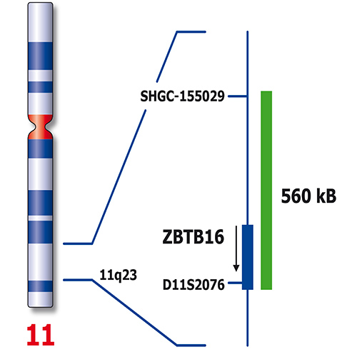 IVD 11q23/DLEU1 product photo Back View S