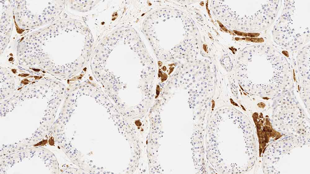 Calretinin product photo