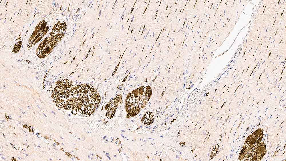 Neuron Specific Enolase product photo Front View S