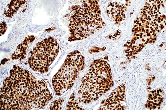 7ML SOX-2 (SP76 Rab) 'CM' Produktfoto