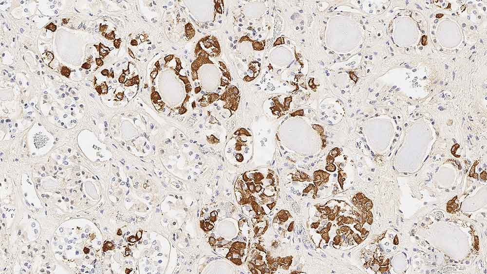 Human Growth Hormone Produktfoto Front View S