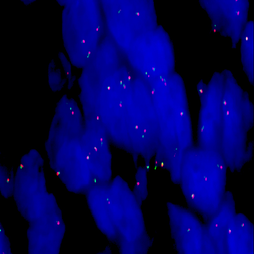 ROS1 (6q22) Break - XL for BOND Produktfoto