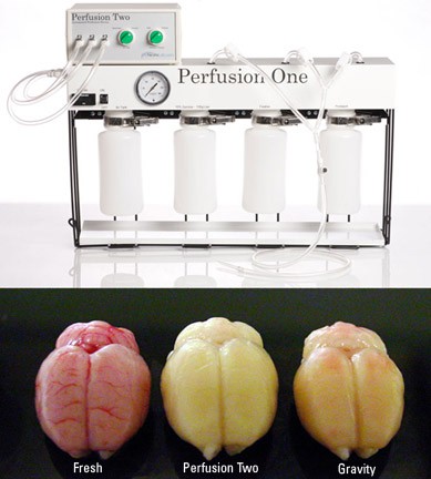 Perfusion Two™ Automated Perfusion Inst. product photo Front View L