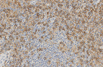 CD4 product photo Front View S