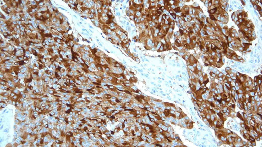 Calcitonin product photo Front View S