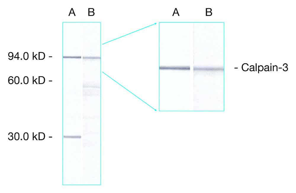 Calpain Antibodies product photo Front View S