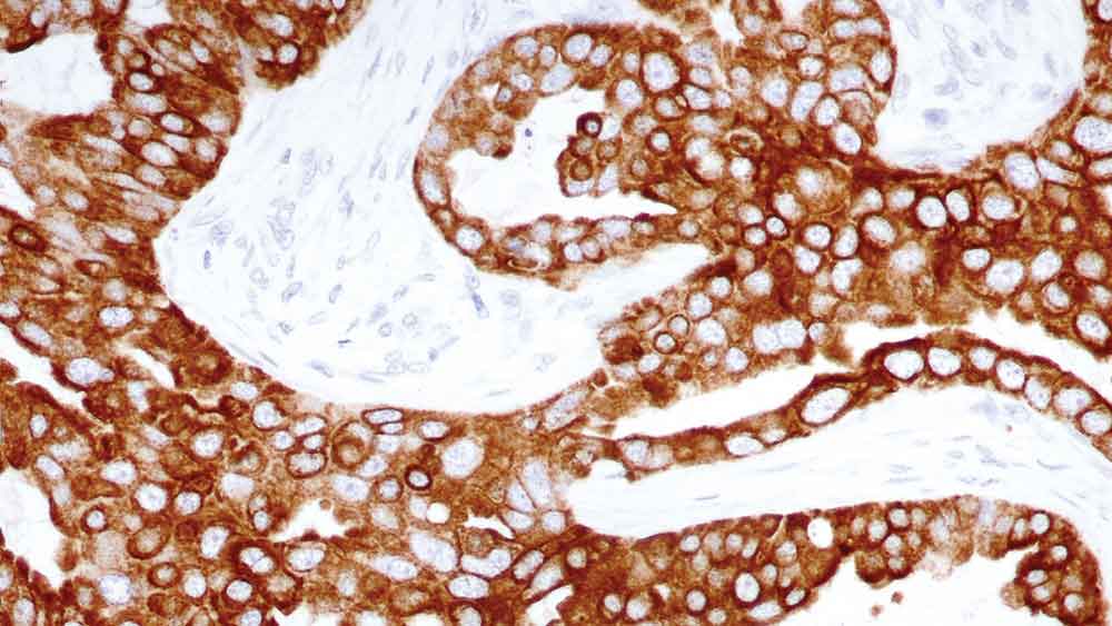 Cytokeratin 8 product photo Front View S